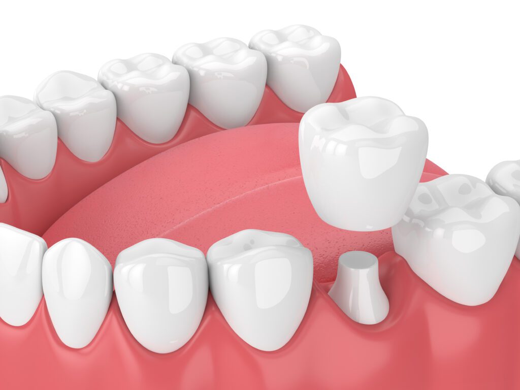 Dentist in Collegeville