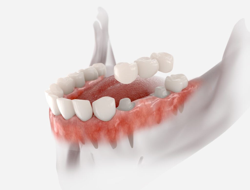 Dentist in Collegeville