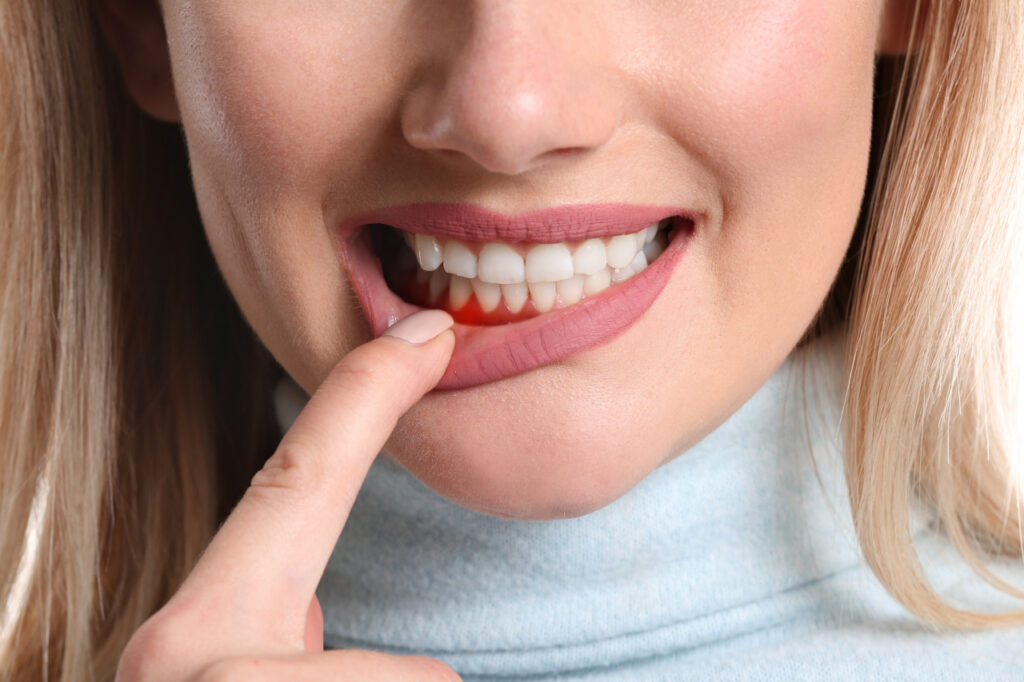 Gum Recession in Collegeville, PA: How to Protect Your Gumline Before Problems Progress