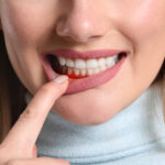 Gum Recession in Collegeville, PA: How to Protect Your Gumline Before Problems Progress